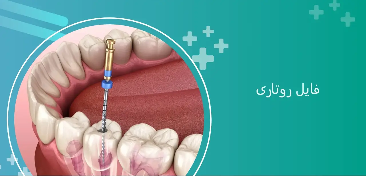 روتاری دندانپزشکی