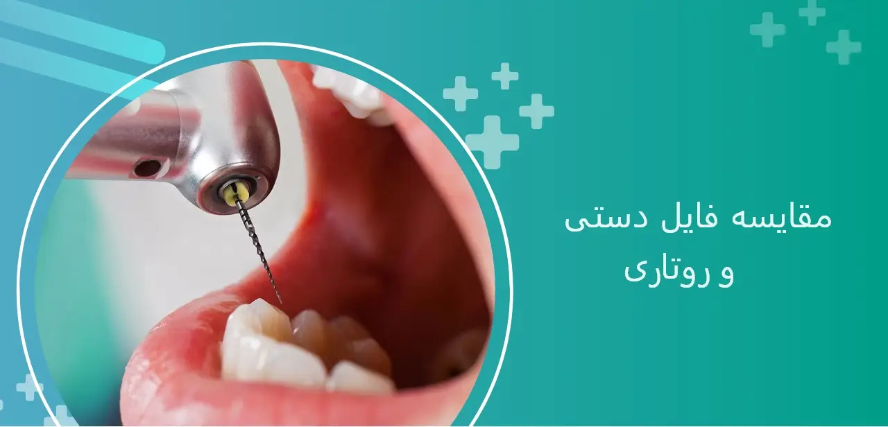 مقایسه فایل دستی و روتاری