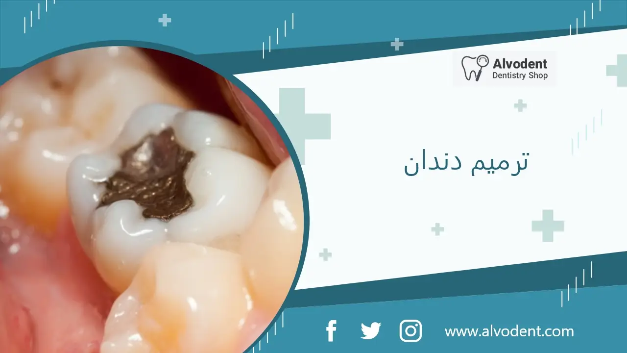 ترمیم دندان