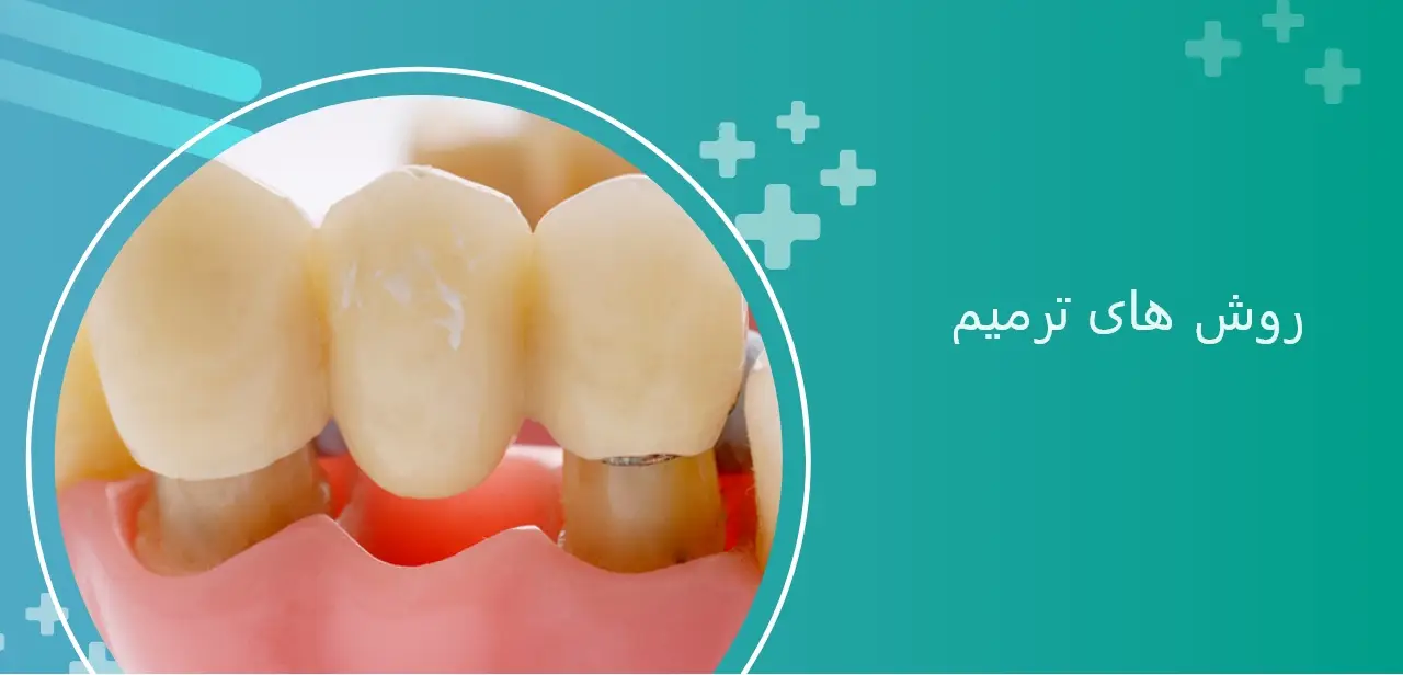 روشهای ترمیم