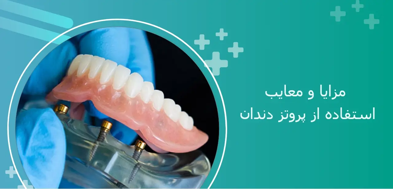 مزایا و معایب استفاده از پروتز دندان