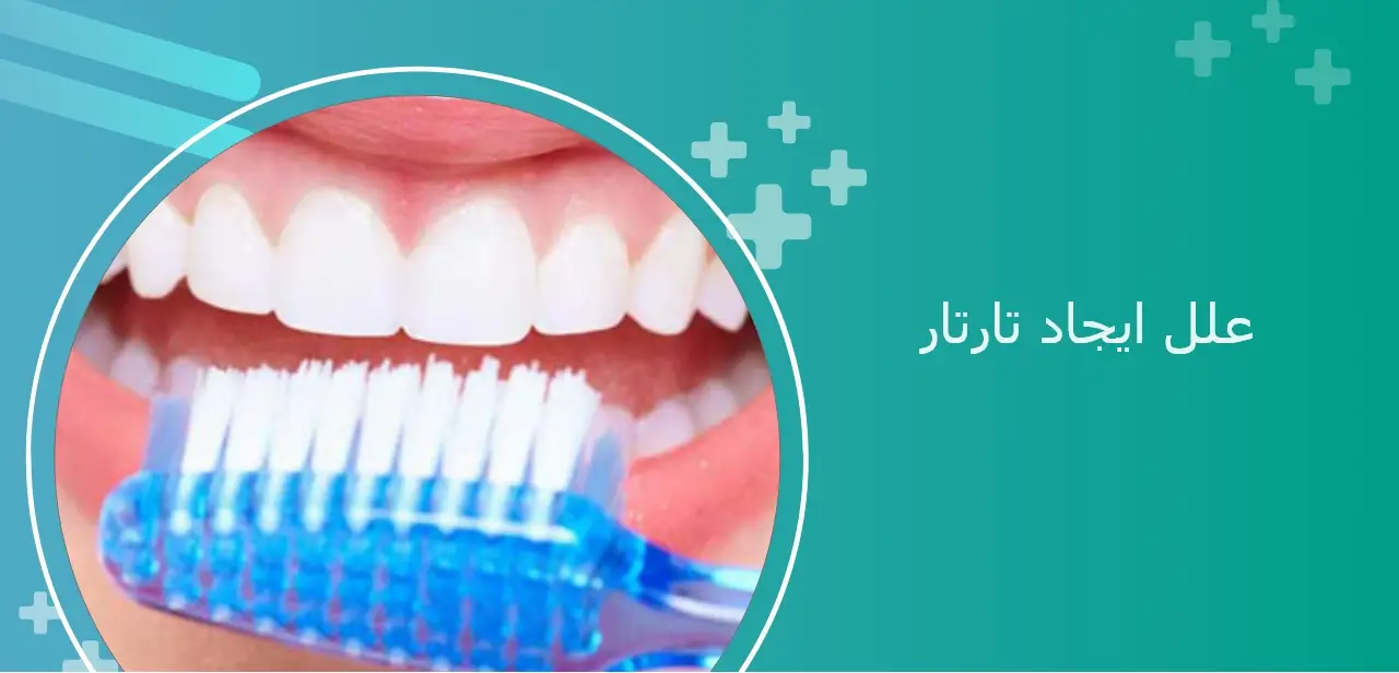 تارتار